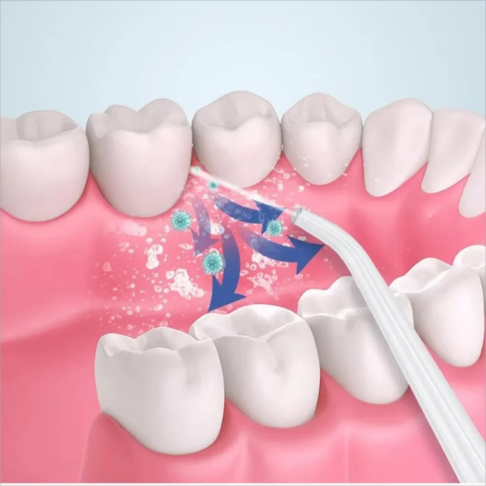 3-in-1 Portable Electric Oral Irrigator – Water Floss, Teeth Whitening & Gum Care