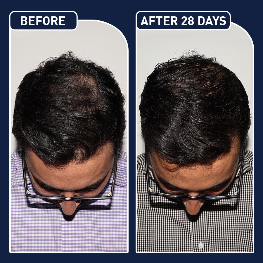 FEG Plus Hair Spray – Strengthen & Revitalize Hair in KSA