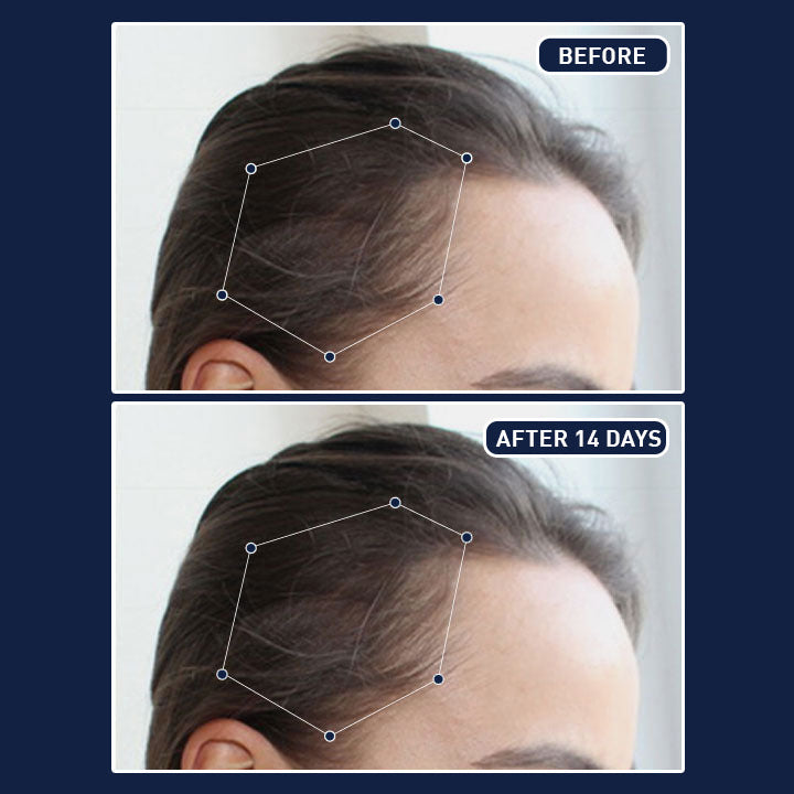 FEG Plus Hair Spray – Strengthen & Revitalize Hair in KSA